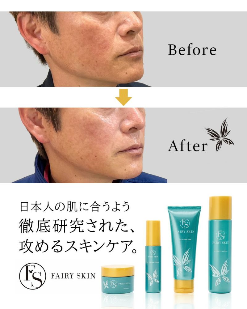 フェアリースキン HQピーリングウォッシュフォーム | Ai CLINIC